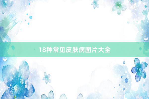 18种常见皮肤病图片大全